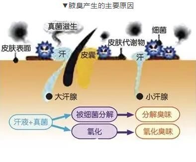 腋臭產(chǎn)生的主要原因介紹