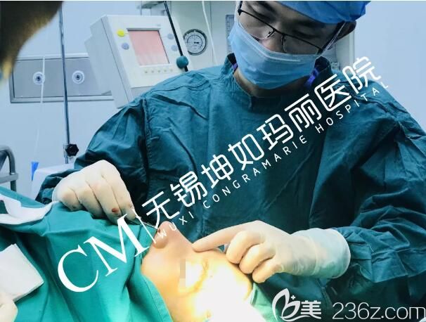 你所想了解的耳軟骨墊鼻尖+鼻小柱延長綜合鼻整形手術詳細過程在無錫坤如瑪麗已公開