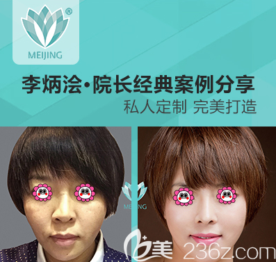 北京美憬李炳澮醫(yī)生肋軟骨鼻綜合隆鼻案例