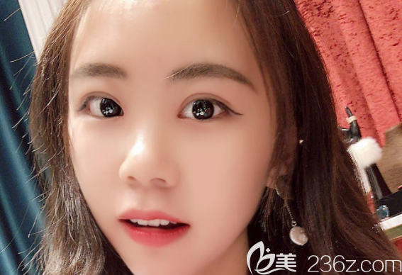 大愛！盧相勛整形盧相勛給開了眼角+雙眼皮+提肌我從土妞變成洋氣妞