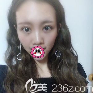 黑龍江瑞麗段興超做的眼部修復(fù)挺不錯(cuò)的，點(diǎn)開看我做的效果和價(jià)格