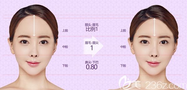 韓國TJ整形外科額頭縮小術(shù)美學(xué)