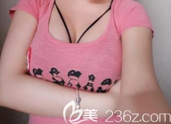 我在北海韓美做假體隆胸術(shù)后第15天 我在北海韓美做假體隆胸術(shù)后第15天