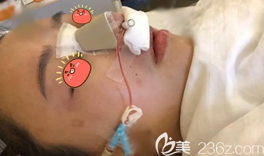 義烏連天美隆鼻<span style= 義烏連天美隆鼻<span style=