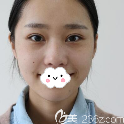 找<i data-id='80057854-710c-4b8d-856f-9faaf1974202' style='display:none;'></i>文科做鼻子前的素顏照 找<i data-id='80057854-710c-4b8d-856f-9faaf1974202' style='display:none;'></i>文科做鼻子前的素顏照