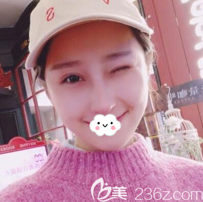 鼻綜合手術(shù)后一個月的恢復(fù)圖片 鼻綜合手術(shù)后一個月的恢復(fù)圖片