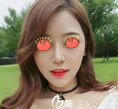 義烏連天美隆鼻<span style=