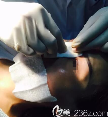 鼻子注射玻尿酸后還需要捏造塑形 鼻子注射玻尿酸后還需要捏造塑形