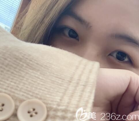 近視矯正BalGeunSeSang光明世界lasek+角膜強化，本來是想做icl晶體植入的