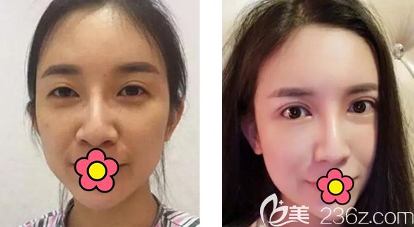 蘭州時(shí)光相伴張曉萍修復(fù)眼睛怎么樣 蘭州時(shí)光相伴張曉萍修復(fù)眼睛怎么樣