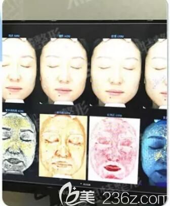 檢測出來的面部斑點問題 檢測出來的面部斑點問題