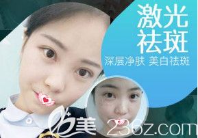 石家莊雅芳亞做激光祛斑案例