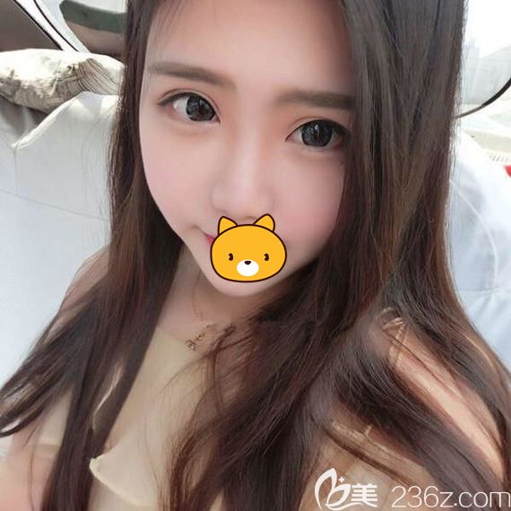 哈爾濱瑞麗注射瘦臉10天 哈爾濱瑞麗注射瘦臉10天