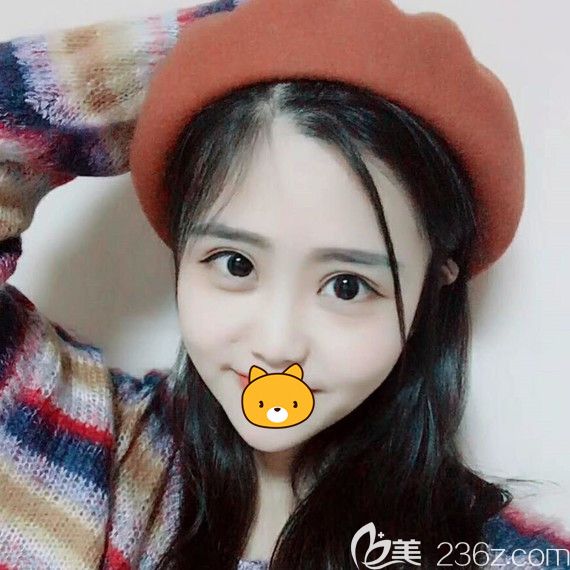 參考：把我在哈爾濱瑞麗整形美容醫(yī)院找徐明注射瘦臉的恢復(fù)效果和價(jià)格一并分享給大家