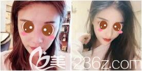 <!--<i data=20240703-sp></i>-->藝星隆鼻真人