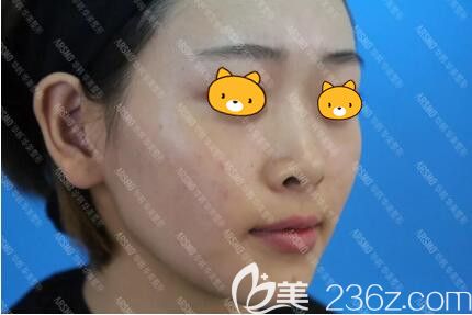 做注射英諾前照 做注射英諾前照