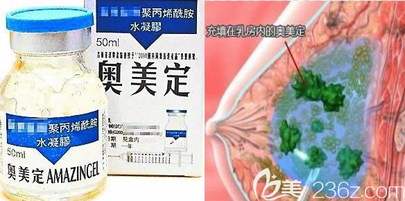 長(zhǎng)春哪家醫(yī)院能取奧美定 長(zhǎng)春哪家醫(yī)院能取奧美定