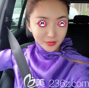 北京美萊劉崇醫(yī)生超皮秒祛斑案例