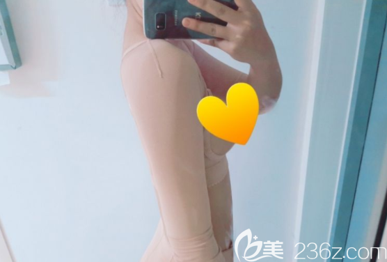 維摩整形外科吸脂怎么樣