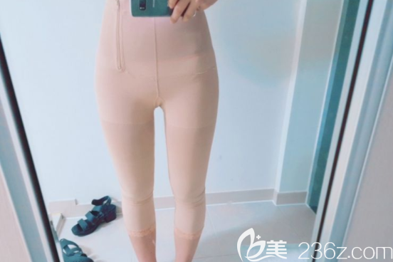 維摩整形外科吸脂案例