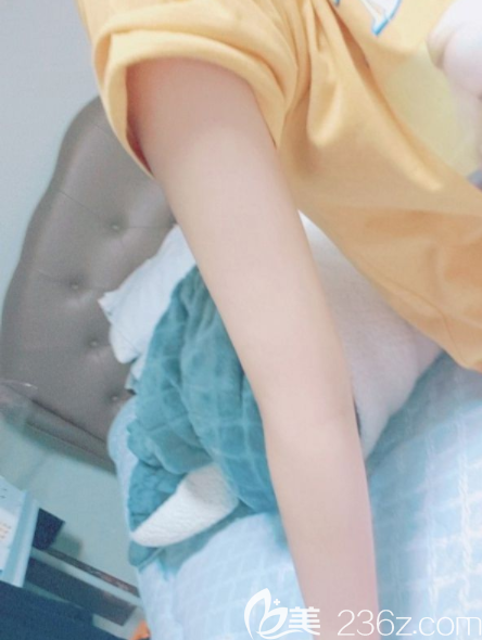 姜在九吸脂費(fèi)用