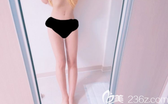 吸脂后一個(gè)月