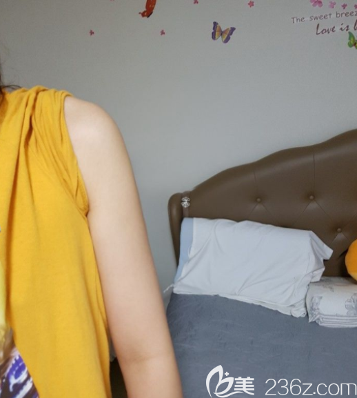 吸脂一個(gè)月