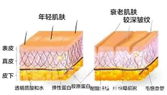 醫(yī)院分析皮膚抗衰老的情況 醫(yī)院分析皮膚抗衰老的情況