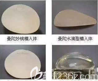 曼托假體形態(tài)示意圖