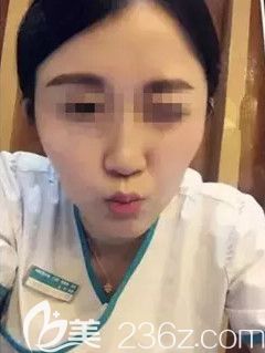 丁慶豐院長為我做假體隆下巴術后18天擁有立體下巴 丁慶豐院長為我做假體隆下巴術后18天擁有立體下巴