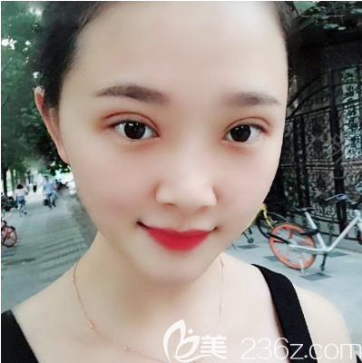 上周去佛山醫(yī)博士找劉哲主任做完雙眼皮后拿了張醫(yī)院整形價(jià)格表