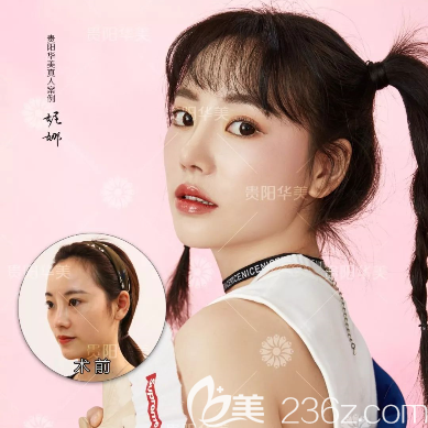 貴陽(yáng)華美做鼻修復(fù)怎么樣？