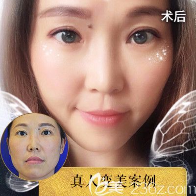 深圳潤澤瑞尼絲于甫面部<span style=