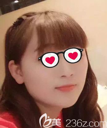 呼和浩特大韓整形注射瘦臉前照片 呼和浩特大韓整形注射瘦臉前照片