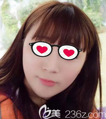 瘦臉除皺瘦臉半個(gè)月效果 瘦臉除皺瘦臉半個(gè)月效果