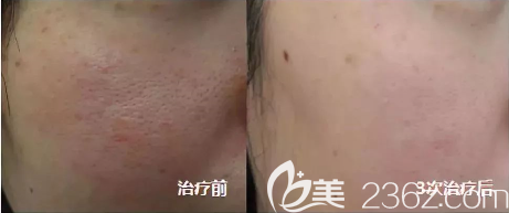 貴陽(yáng)美萊美膚案例