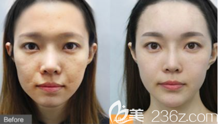 貴陽(yáng)美萊美膚效果怎么樣