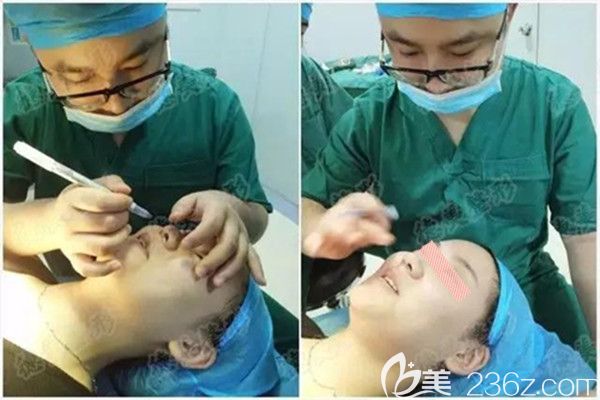 符主任做鼻綜合術(shù)前設(shè)計