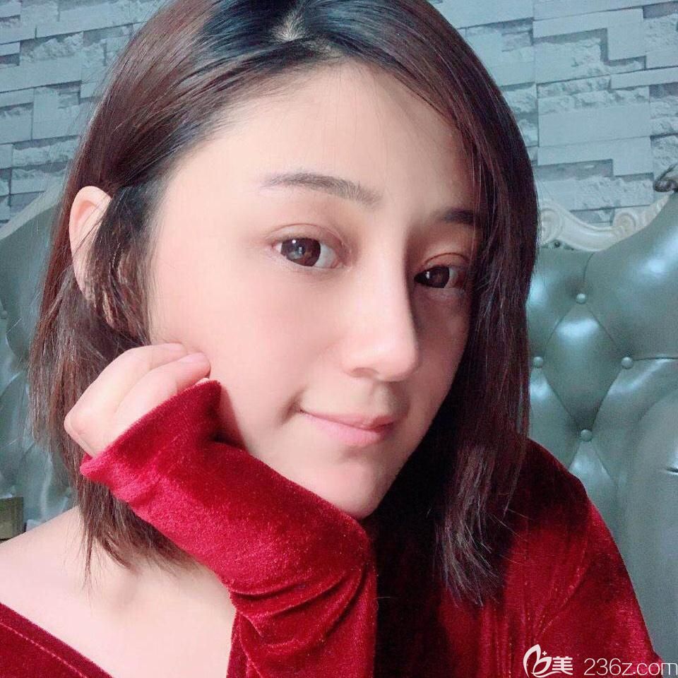 胡準(zhǔn)眼鼻綜合時(shí)候第10天恢復(fù)情況 胡準(zhǔn)眼鼻綜合時(shí)候第10天恢復(fù)情況