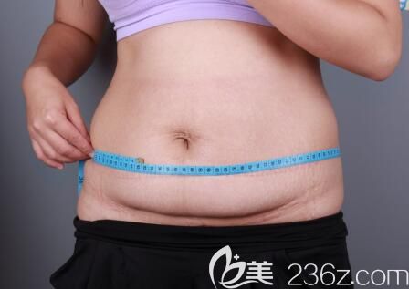 我在南寧韓星整形做腰腹部環(huán)形吸脂前的照片 我在南寧韓星整形做腰腹部環(huán)形吸脂前的照片