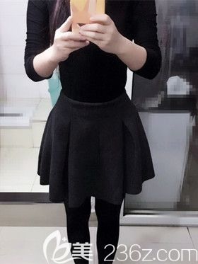 找南寧韓星整形院長(zhǎng)做腰腹部360度水動(dòng)力環(huán)形吸脂1個(gè)月?lián)碛行⌒U腰，分享我的親身經(jīng)歷