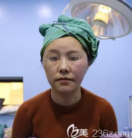 鹽城東方陳錦添分享一側(cè)臉做線雕效果對比