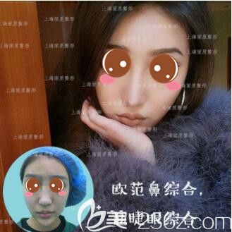 <!--<i data=20240703-sp></i>-->麗質醫(yī)療美容醫(yī)院鼻綜合真人