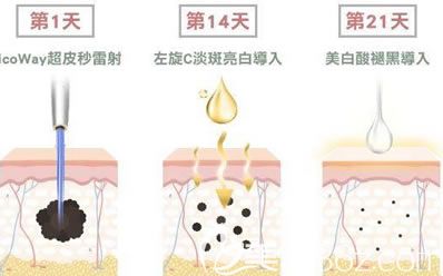 做一次超皮秒能維持多久