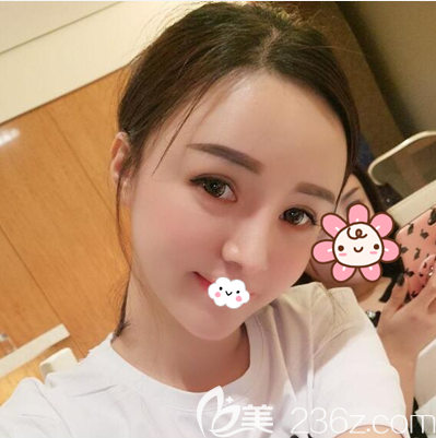 成都西區(qū)醫(yī)院脂肪填充術(shù)后一周 成都西區(qū)醫(yī)院脂肪填充術(shù)后一周