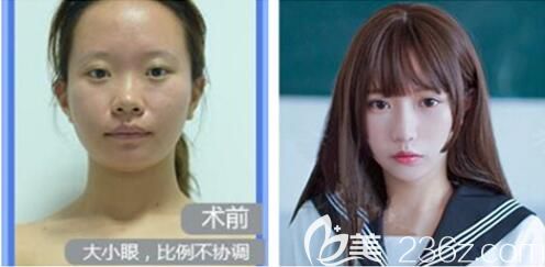 美萊混血芭比眼