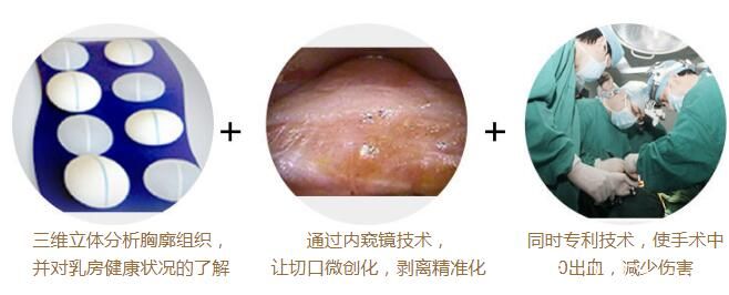 <!--<i data=20240703-sp></i>-->隆胸取出技術(shù) <!--<i data=20240703-sp></i>-->隆胸取出技術(shù)