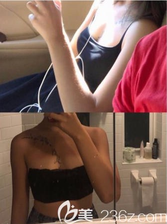 韓國PJS樸真奭做胸怎么樣 韓國PJS樸真奭做胸怎么樣