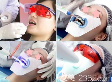 泉州維樂口腔王燕燕醫(yī)生牙齒美白過程圖