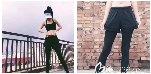 東莞抽脂減肥哪家醫(yī)院好 東莞抽脂減肥哪家醫(yī)院好